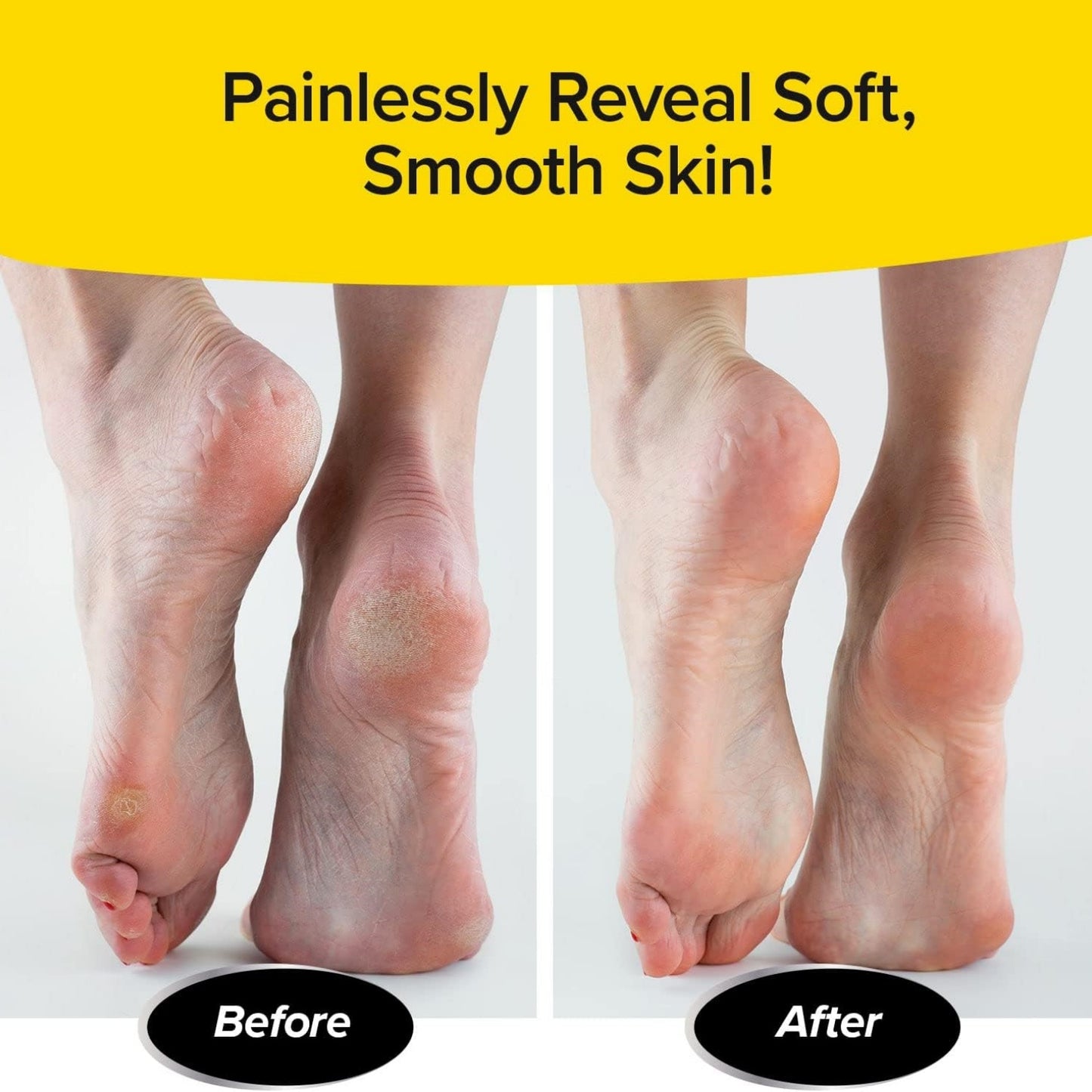 PedEgg Jumbo , Gently Removes Calluses & Dry Skin